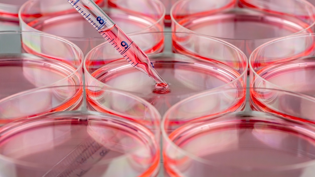 Human Induced Pluripotent Stem Cells (iPS)