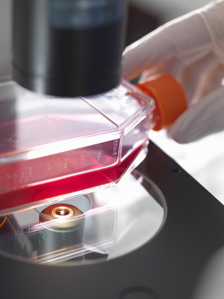 SH-SY5Y Cell Line Stably Expressing Human tau 2N4R isoform with P301L Mutant