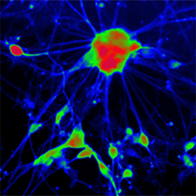 [26sk153] Reporter Cells (Endothelial Cells)